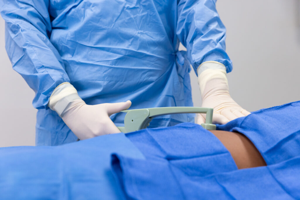 A Faulkner provider in a blue surgical gown applies the BodyTite hand device to a patient's belly. Having BodyTite near you in Bethesda, MD, helps get rid of stubborn body fat.